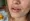 Effective Dry Lips Menopause Treatment: Remedies and Prevention Tips